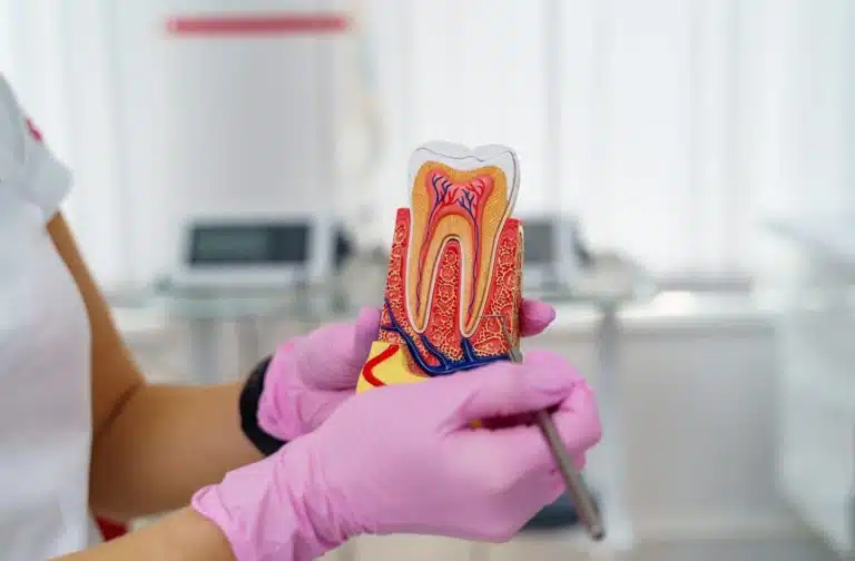Endodontie et équipement de précision